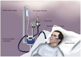 High-Flow Nasal Oxygen