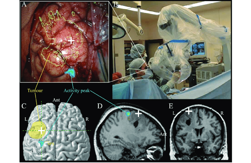 Neuronavigation Systems Market